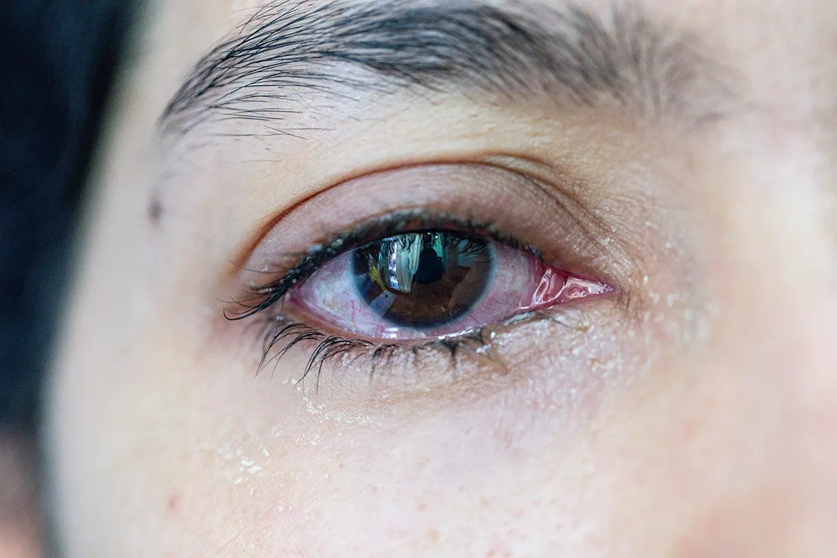 close-up of a woman's eye tearing up