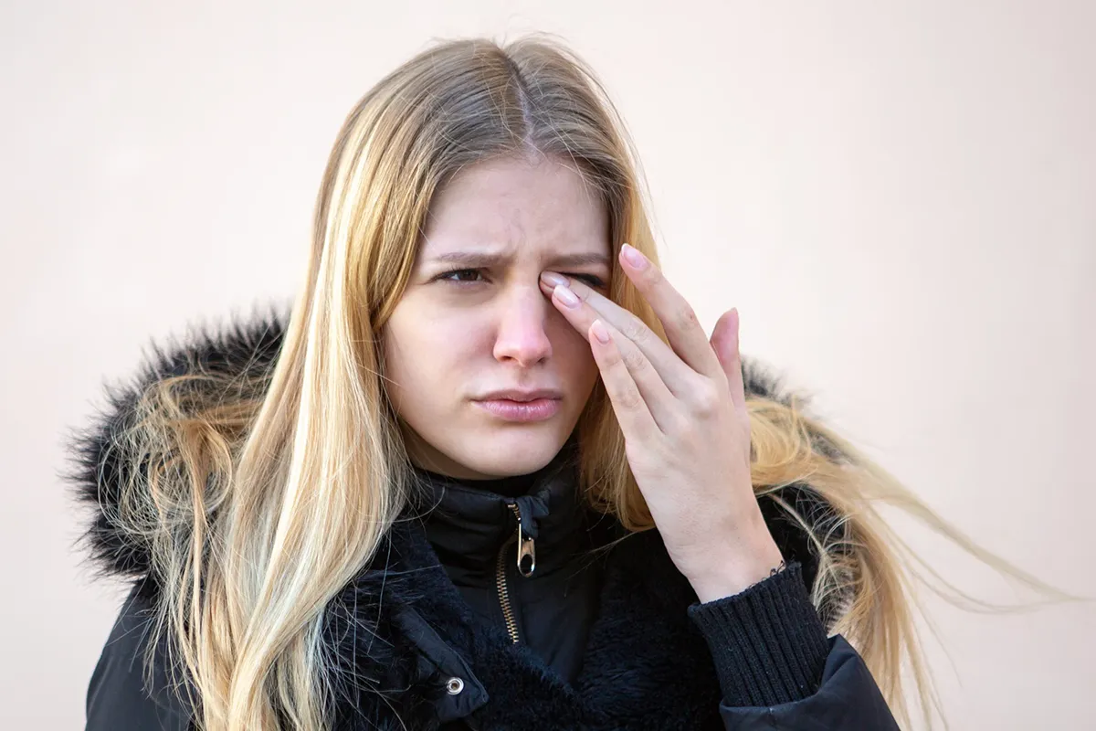 A young woman in a winter coat rubs her eyes from dry eye due to allergies.